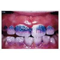 denta-tec-120260710210541689281