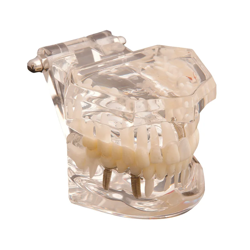 denta-tec-120260712002509888110